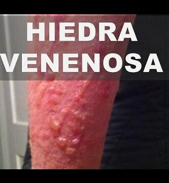 tipos de hiedra venenosa